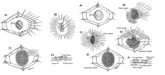 ��������������